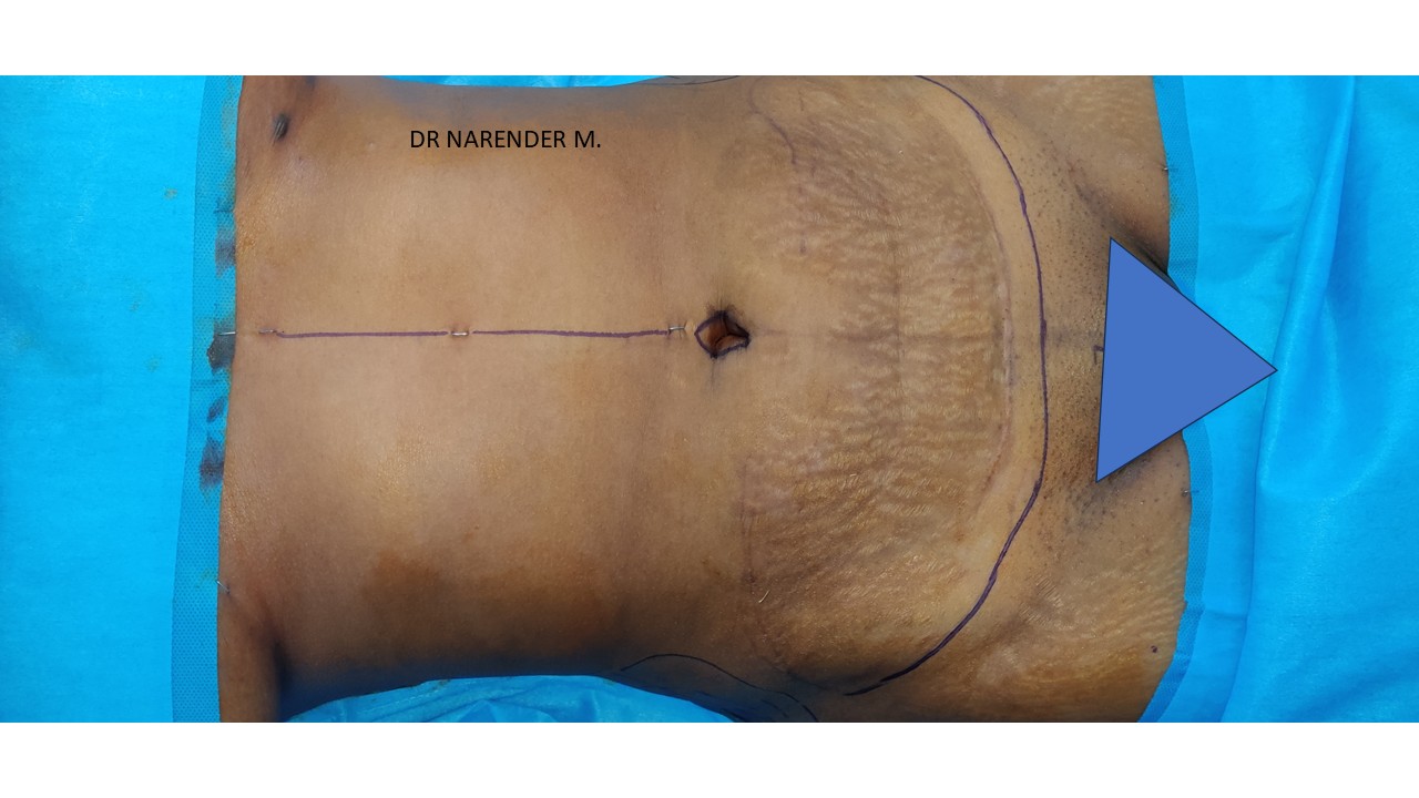 Suvarna Talk Photo 3